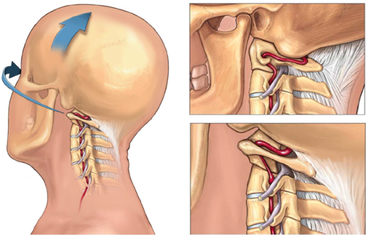 arteria vertebral